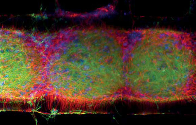 A neural organoid in a 3D-printed scaffold.