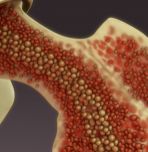 Bone marrow for joint repair