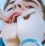 Teen boy getting teeth cleaned; photo by BravissimoS from Getty Images via Canva.com